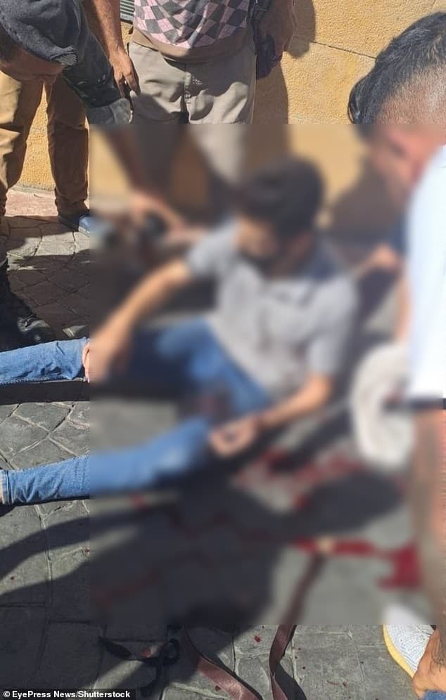 有人的下體被炸傷。（翻自《每日郵報》）