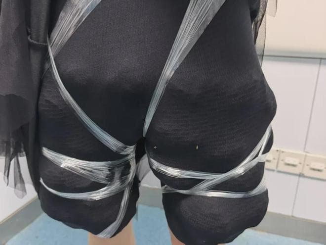 涉案女子雙腿密密麻麻全是活體陸龜，令人看傻眼。（翻攝自極目新聞）